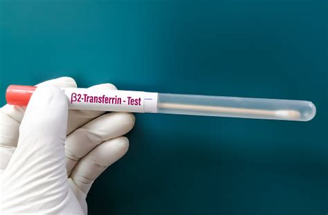 Nasal Fluid Sample Beta 2 Transferrin Test For The Diagnosis Of Csf