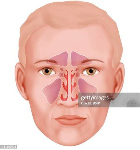 Maxillary Sinuses Photos And Premium High Res Pictures Getty Images