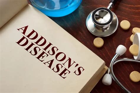 How To Code For Addison S Disease Using Icd 10 Medical Codes