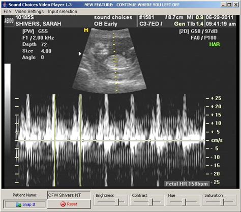 The Shivers Family: 3 Month UltraSound