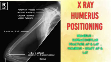 Upper Arm XrAy AP Lat Humerus X Ray Humerus Positioning X Ray