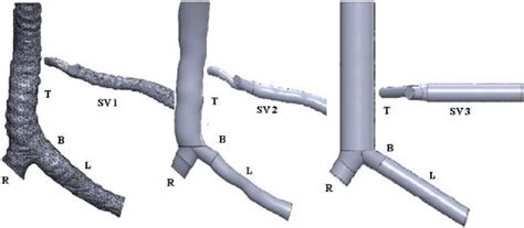 3d Views Of Trachea T Bifurcation B Right Bronchi R And Left