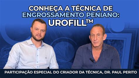 Conheça A Técnica De Engrossamento Peniano Urofill™ Youtube