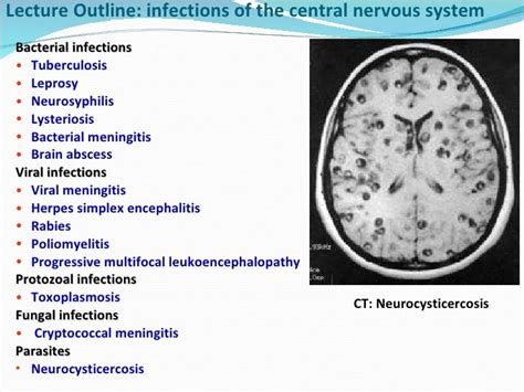 Cns infections Lecture