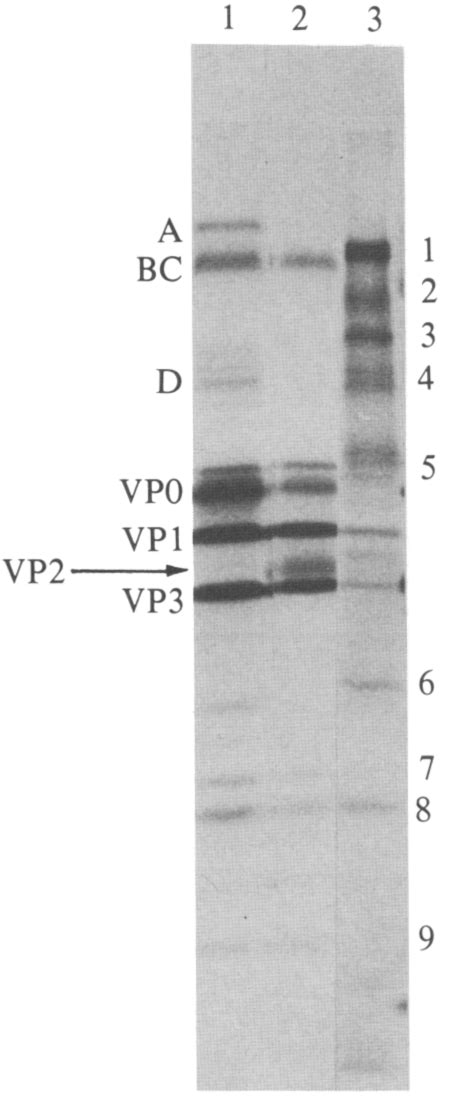 Autoradiogram Of 35s Methionine Labelled Proteins Separated On A 175