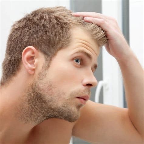 Hair Loss Management For Men Vie Aesthetics