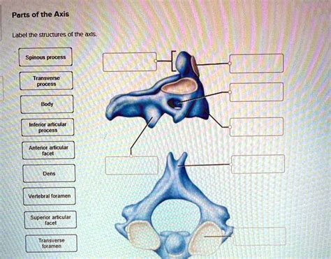 Parts Of The Axis Label The Structures Of The Axis Spinous Process