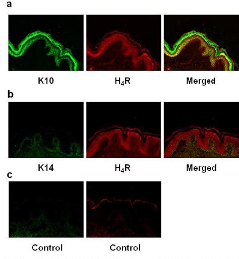 Figure 1 From Expression Of The Histamine H4 Receptor In Human Tissue