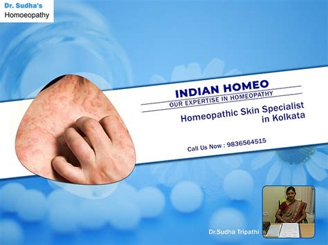 1homeopathic Skin Specialist In Kolkata Dr Sudha Tripathi Flickr