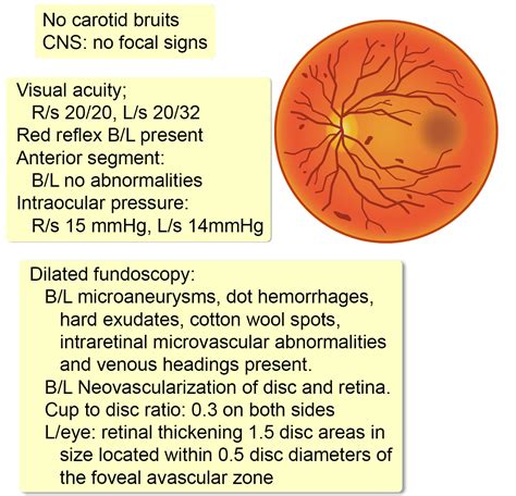 Clinically Significant Macular Edema