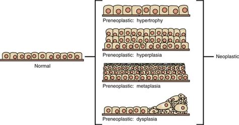 Neoplasia And Tumor Biology Veterian Key