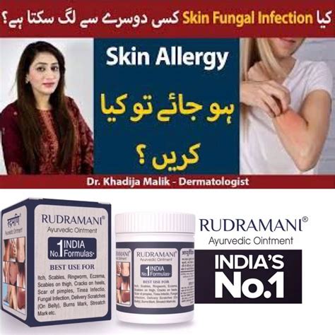 Rudramani Ayurvedic Ointment Skin Allergy Treatment At Rs 100 Herbal