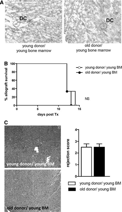 CD11c+ Dendritic Cells Accelerate the Rejection of Older Cardiac ...