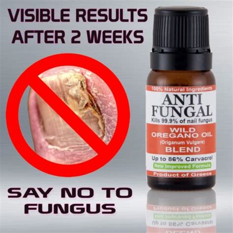 Anti Fungal Wild Oregano Oil Toenail Fungus Athlete S Foot Nail Treatment Fungi Ebay