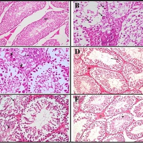 A Testis Of Control Mice Showing Normal Spermatogenesis Within The Download Scientific Diagram