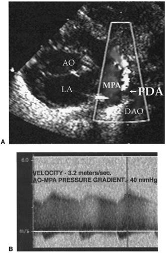 Diagnostic Tools Obgyn Key