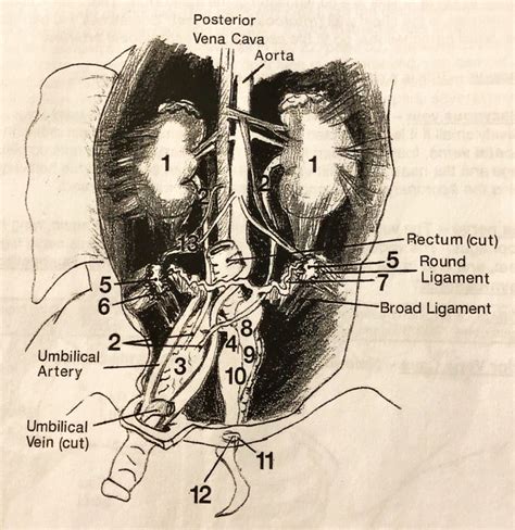 Pig Anatomy (Female Genitourinary Structures) Diagram | Quizlet