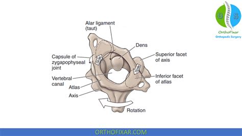 Alar Ligament Test | OrthoFixar 2025