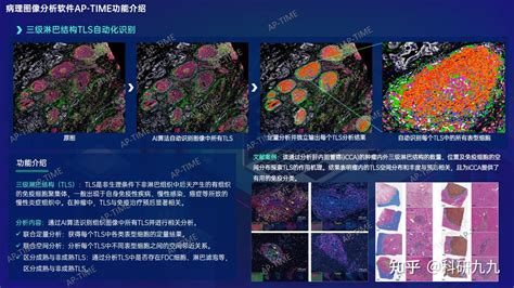 多重荧光多色荧光免疫组化图像分析 免疫荧光技术 社区 小桔灯网 体外诊断新媒体 IIVD NET