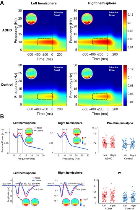 Eeg Plot A Group Average Time Frequency Map With Relative Power And