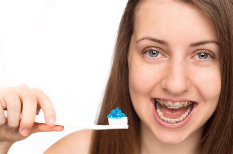 Braces Colors For Girls Teeth