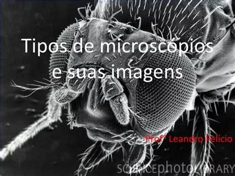 Ppt Tipos De Microsc Pios E Suas Imagens Powerpoint Presentation