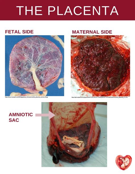 Placental Structure Part 1 By The Placenta Lab Issuu