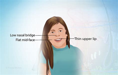 Health Condition : Symptoms, Causes, Treatment and More