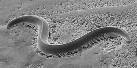 New molecular targets for drugs to treat human and animal nematode ...