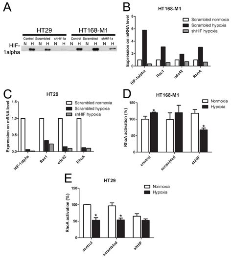 Effect Of Hif Gene Silencing On Protein And Mrna Expression And Rhoa