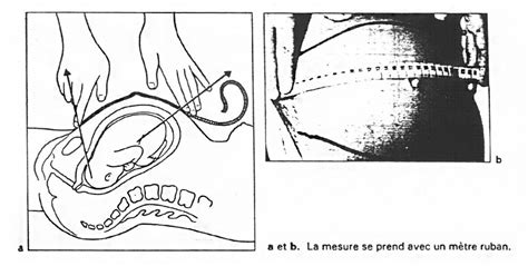 Mesure De La Hauteur Utérine Dr KARA ZAITRI M A