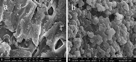 Scanning Electron Micrographs Of Rice Husk Ash With Scales Of A 5 µm