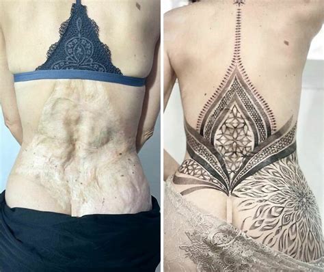 30 Times Tattoo Artists Made Incredible Scar And Birthmark Cover Up ...