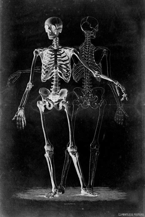 Two Skeletons On Black Gothic Poster In 2024 Dark Art Illustrations Dark Drawings Skeleton Art