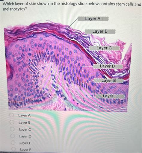 Layers Of Skin Histology 2 Skin Histology With Garland At