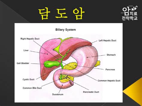 담도암 5년 생존율 20어떻게 알아채나 부산의 대표 정론지 국제신문