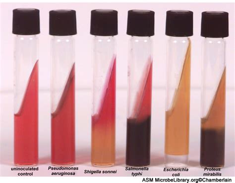 Enterobacteriaceae Vibrio Campylobacter And Helicobacter