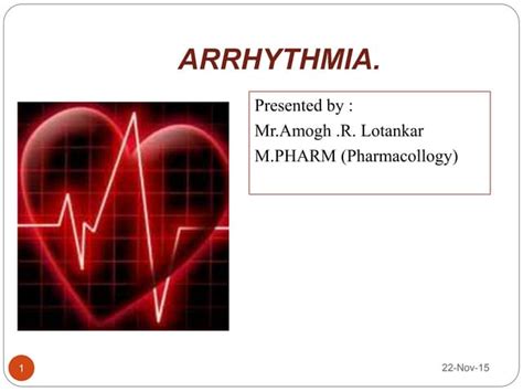 Arrhythmia Ppt