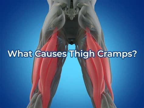 Thigh Cramps 6 Possible Causes Symptoms Treatments And Prevention