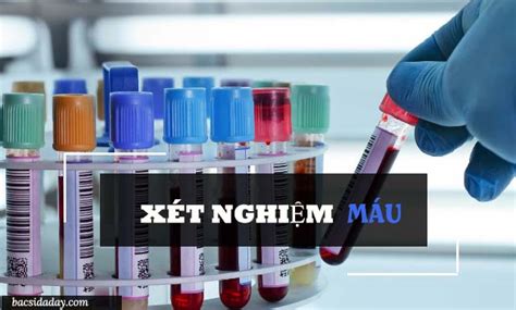 Phác đồ điều Trị Vi Khuẩn Hp Dạ Dày Mới Nhất Của Bộ Y Tế Thợ Sửa Máy