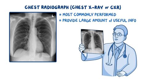 Chest X Ray Interpretation Clinical Sciences V Deo Osmosis