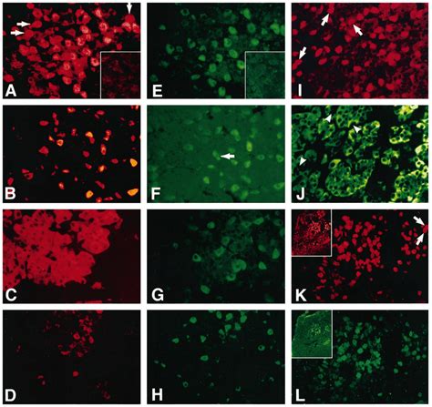 Double Immunofluorescent Staining For Lh A Fsh B Prl C Or Gh