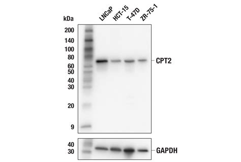 Cpt E D W Rabbit Mab Cell Signaling Technology