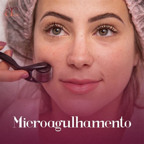 Curso Microagulhamento Skinbooster Thiago Henrique Hotmart