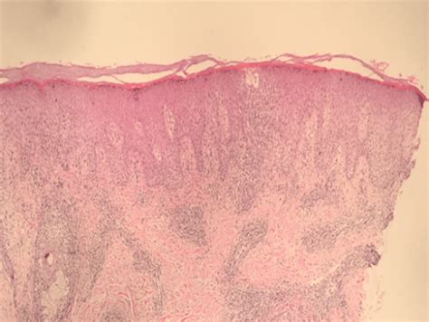 Hematoxylin And Eosin Stain In 10x Download Scientific Diagram