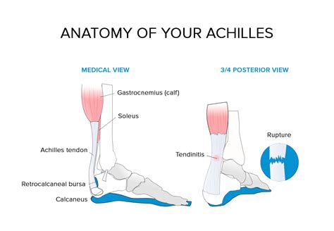 Treat Sore Achilles Running Hotsell Plain Bearing Ru