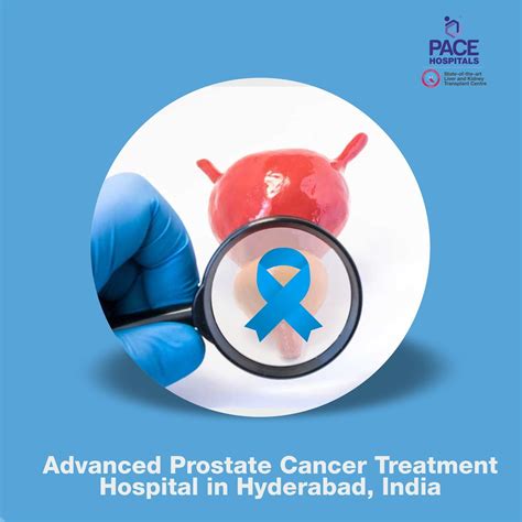 Best Hospital For Prostate Cancer Treatment In Hyderabad