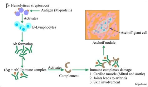 Chapter 25 Autoimmune Diseases Rheumatic Fever