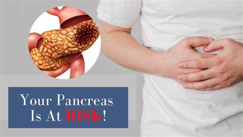 Jaundice To Acute Pancreatitis Doctor Shares 4 Unusual Warning Symptoms Of Pancreas Cancer