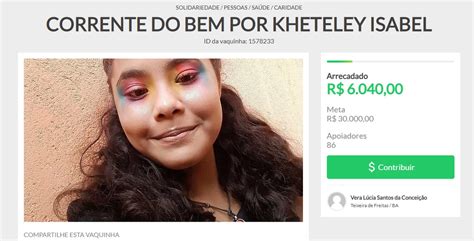 Família de adolescente baiana escoliose faz vaquinha virtual para